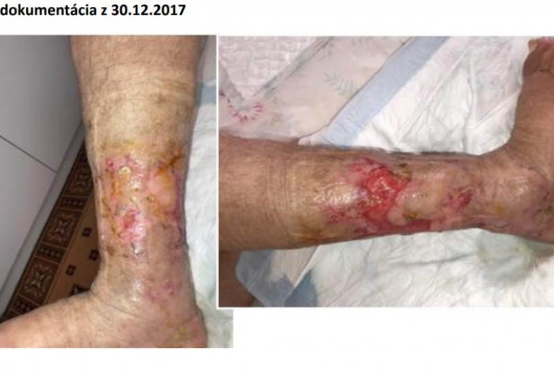 Odborné články / Zdravie je dobro o ktorom nevieme, kým ho nestratíme. (Walther) - foto Odborné články / Zdravie je dobro o ktorom nevieme, kým ho nestratíme. (Walther) - foto