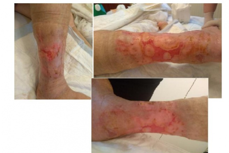 Odborné články / Zdravie je dobro o ktorom nevieme, kým ho nestratíme. (Walther) - foto Odborné články / Zdravie je dobro o ktorom nevieme, kým ho nestratíme. (Walther) - foto