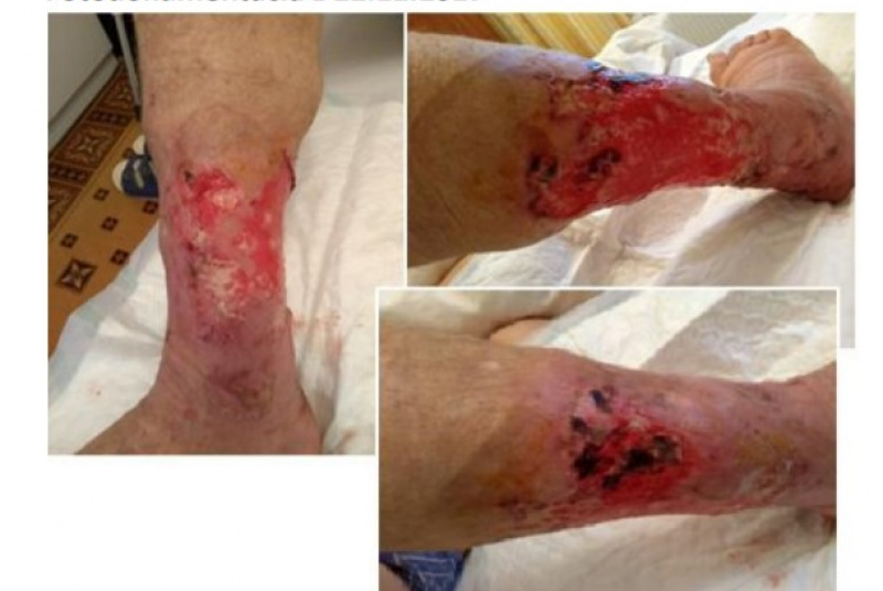  Odborné články / Zdravie je dobro o ktorom nevieme, kým ho nestratíme. (Walther) - foto