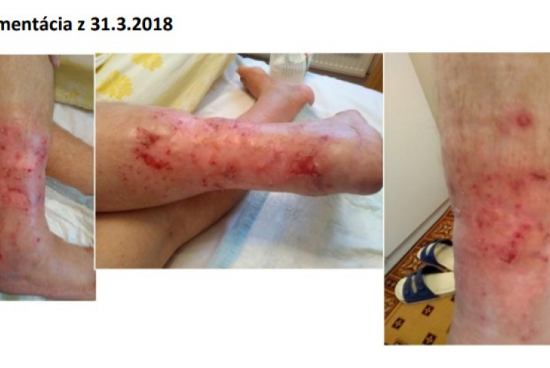  Odborné články / Zdravie je dobro o ktorom nevieme, kým ho nestratíme. (Walther) - foto